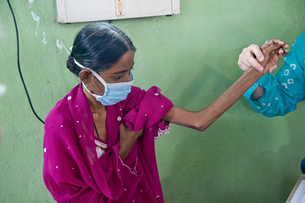 Tuberkulose-Patientin im St. Thomas-Home, Shibpur, Kolkata